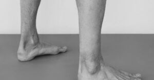 feet Achilles tendon - collagen for tendons